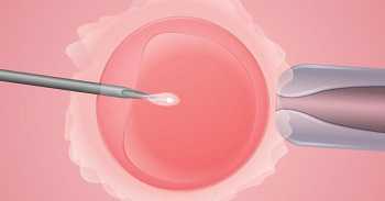 包皮环切手术费用明细：辅助生殖备孕期间的男性生殖健康指南