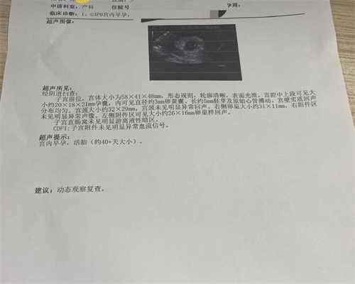 2026年医学解析：始基子宫与幼稚子宫是否由卵巢发育不良引起？如何应对生育挑战