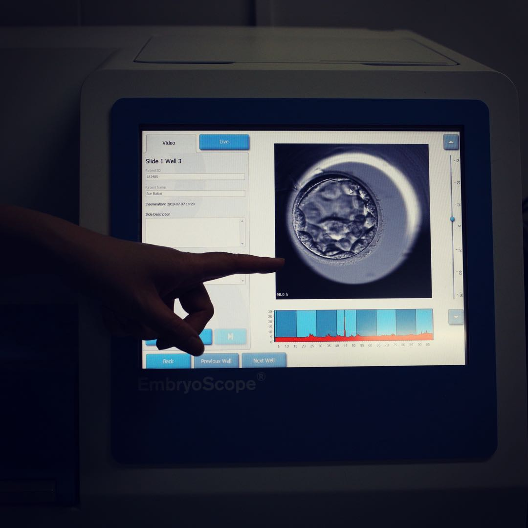 2026年卵巢AMH正常值标准对照:评估捐卵储备与试管婴儿成功率